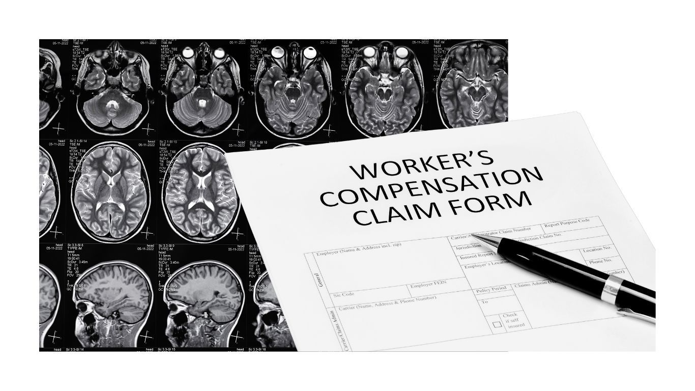TBI Workers Comp